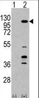 PIK3CG / PI3K Gamma Antibody - Western blot of anti-PIK3CG Antibody antibody in 293 cell line lysates transiently transfected with the PIK3CG gene (2 ug/lane). PIK3CG(arrow) was detected using the purified antibody.