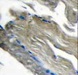 PIK3CG / PI3K Gamma Antibody - Formalin-fixed and paraffin-embedded human muscle tissue tissue reacted with PI3CKG antibody , which was peroxidase-conjugated to the secondary antibody, followed by DAB staining. This data demonstrates the use of this antibody for immunohistochemistry; clinical relevance has not been evaluated.