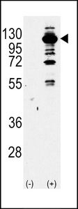 PIK3CG / PI3K Gamma Antibody - Western blot of PI3KCG Antibody antibody (arrow) using purified antibody. 293 cell lysates (2 ug/lane) either nontransfected (Lane 1) or transiently transfected with the PI3KCG gene (Lane 2) (Origene Technologies).