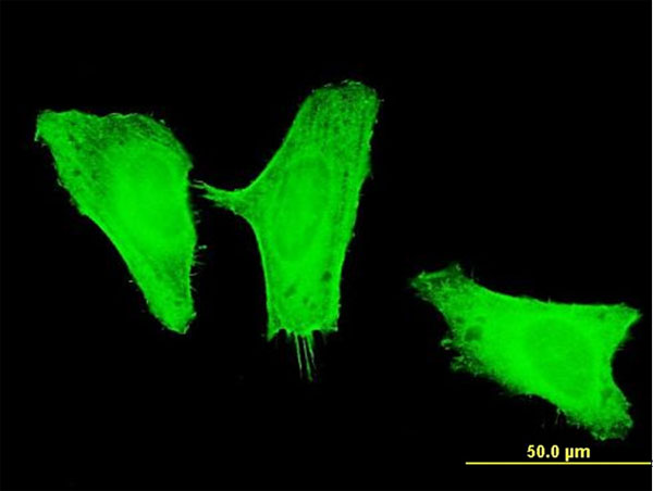 PIK3CG / PI3K Gamma Antibody - Immunofluorescence of monoclonal antibody to PIK3CG on HeLa cell . [antibody concentration 10 ug/ml]