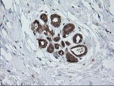 PIK3CG / PI3K Gamma Antibody - IHC of paraffin-embedded Human breast tissue using anti-PIK3CG mouse monoclonal antibody.
