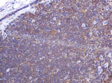 PIK3CG / PI3K Gamma Antibody - IHC of paraffin-embedded Human lymph node tissue using anti-PIK3CG mouse monoclonal antibody.