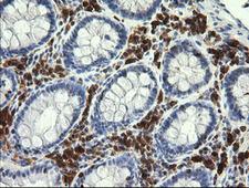 PIK3CG / PI3K Gamma Antibody - IHC of paraffin-embedded Human colon tissue using anti-PIK3CG mouse monoclonal antibody.