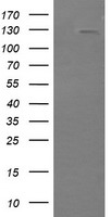 PIK3CG / PI3K Gamma Antibody - HEK293T cells were transfected with the pCMV6-ENTRY control (Left lane) or pCMV6-ENTRY PIK3CG (Right lane) cDNA for 48 hrs and lysed. Equivalent amounts of cell lysates (5 ug per lane) were separated by SDS-PAGE and immunoblotted with anti-PIK3CG.
