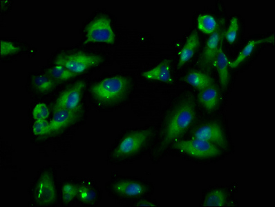 PIK3IP1 / HGFL Antibody - Immunofluorescence staining of Hela cells at a dilution of 1:100, counter-stained with DAPI. The cells were fixed in 4% formaldehyde, permeabilized using 0.2% Triton X-100 and blocked in 10% normal Goat Serum. The cells were then incubated with the antibody overnight at 4 °C.The secondary antibody was Alexa Fluor 488-congugated AffiniPure Goat Anti-Rabbit IgG (H+L) .