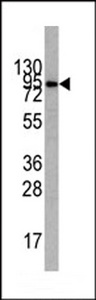 PIK3R1 / p85 Alpha Antibody - Western blot of anti-PIK3R1 Antibody (N-term L11) antibody in CEM cell line lysates (35 ug/lane). PIK3R1(arrow) was detected using the purified antibody.