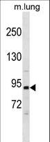 PIK3R1 / p85 Alpha Antibody - Mouse Pik3r1 Antibody western blot of mouse lung tissue lysates (35 ug/lane). The Mouse Pik3r1 antibody detected the Mouse Pik3r1 protein (arrow).