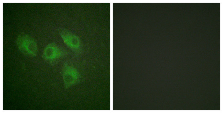 PIK3R1 / p85 Alpha Antibody - Immunofluorescence analysis of HeLa cells, using PI3-kinase p85-alpha Antibody. The picture on the right is blocked with the synthesized peptide.