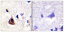 PIK3R1 / p85 Alpha Antibody - Immunohistochemistry analysis of paraffin-embedded human brain tissue, using PI3-kinase p85-alpha Antibody. The picture on the right is blocked with the synthesized peptide.