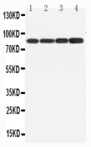 PIK3R1 / p85 Alpha Antibody - WB of PIK3R1 / p85 Alpha antibody. All lanes: Anti-PIK3R1 at 0.5ug/ml. Lane 1: MCF-7 Whole Cell Lysate at 40ug. Lane 2: HELA Whole Cell Lysate at 40ug. Lane 3: COLO Whole Cell Lysate at 40ug. Lane 4: SW620 Whole Cell Lysate at 40ug. Predicted bind size: 85KD. Observed bind size: 85KD.