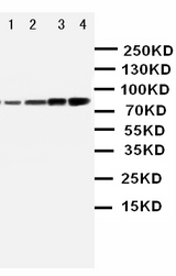 PIK3R1 / p85 Alpha Antibody - Anti-PI 3 Kinase p85 alpha antibody, Western blotting Lane 1: MCF-7 Cell LysateLane 2: HELA Cell LysateLane 3: COLO-320 whole cell lysateLane 4: SW620 Cell Lysate