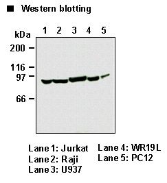 PIK3R1 / p85 Alpha Antibody
