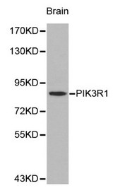 PIK3R1 / p85 Alpha Antibody - Western blot of PIK3R1 pAb in extracts from mouse brain tissue.