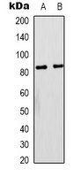PIK3R1 / p85 Alpha Antibody - Western blot analysis of PI3K p85 alpha expression in NIH3T3 (A); rat liver (B) whole cell lysates.