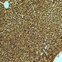 PIK3R1 / p85 Alpha Antibody - Immunohistochemical analysis of PI3K p85 alpha staining in rat liver;mouse brain formalin fixed paraffin embedded tissue section. The section was pre-treated using heat mediated antigen retrieval with sodium citrate buffer (pH 6.0). The section was then incubated with the antibody at room temperature and detected using an HRP conjugated compact polymer system. DAB was used as the chromogen. The section was then counterstained with hematoxylin and mounted with DPX.