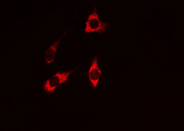 PIK3R1 / p85 Alpha Antibody - Staining COS7 cells by IF/ICC. The samples were fixed with PFA and permeabilized in 0.1% Triton X-100, then blocked in 10% serum for 45 min at 25°C. The primary antibody was diluted at 1:200 and incubated with the sample for 1 hour at 37°C. An Alexa Fluor 594 conjugated goat anti-rabbit IgG (H+L) Ab, diluted at 1/600, was used as the secondary antibody.