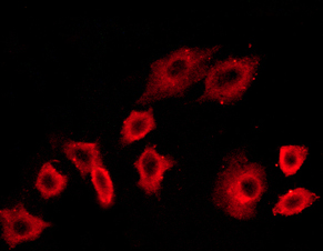 PIK3R1 / p85 Alpha Antibody - Staining NIH-3T3 cells by IF/ICC. The samples were fixed with PFA and permeabilized in 0.1% saponin prior to blocking in 10% serum for 45 min at 37°C. The primary antibody was diluted 1/400 and incubated with the sample for 1 hour at 37°C. A Alexa Fluor 594 conjugated goat polyclonal to rabbit IgG (H+L), diluted 1/600 was used as secondary antibody.