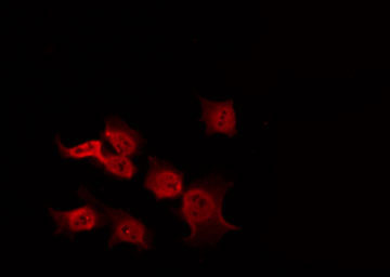 PIK3R1 / p85 Alpha Antibody - Staining COS7 cells by IF/ICC. The samples were fixed with PFA and permeabilized in 0.1% Triton X-100, then blocked in 10% serum for 45 min at 25°C. The primary antibody was diluted at 1:200 and incubated with the sample for 1 hour at 37°C. An Alexa Fluor 594 conjugated goat anti-rabbit IgG (H+L) Ab, diluted at 1/600, was used as the secondary antibody.