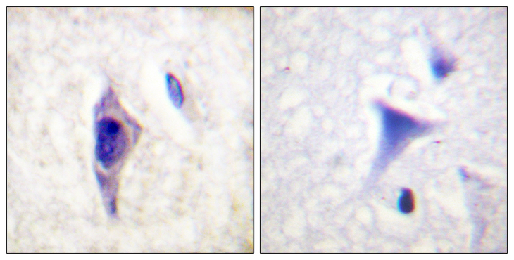 PIK3R1 / p85 Alpha Antibody - Immunohistochemistry analysis of paraffin-embedded human brain, using PI3-kinase p85-alpha (Phospho-Tyr607) Antibody. The picture on the right is blocked with the phospho peptide.
