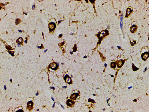 PIK3R1 / p85 Alpha Antibody - 1:200 staining human brain tissue by IHC-P. The tissue was formaldehyde fixed and a heat mediated antigen retrieval step in citrate buffer was performed. The tissue was then blocked and incubated with the antibody for 1.5 hours at 22°C. An HRP conjugated goat anti-rabbit antibody was used as the secondary.