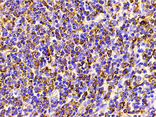 PIK3R1 / p85 Alpha Antibody - 1:200 staining human spleen tissue by IHC-P. The tissue was formaldehyde fixed and a heat mediated antigen retrieval step in citrate buffer was performed. The tissue was then blocked and incubated with the antibody for 1.5 hours at 22°C. An HRP conjugated goat anti-rabbit antibody was used as the secondary.
