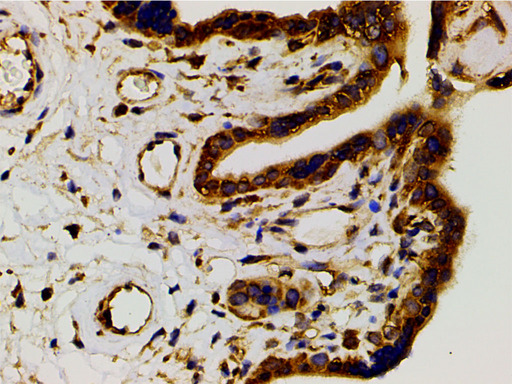 PIK3R1 / p85 Alpha Antibody - 1:200 staining human placenta tissue by IHC-P. The tissue was formaldehyde fixed and a heat mediated antigen retrieval step in citrate buffer was performed. The tissue was then blocked and incubated with the antibody for 1.5 hours at 22°C. An HRP conjugated goat anti-rabbit antibody was used as the secondary.