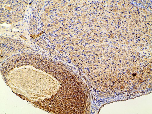 PIK3R1 / p85 Alpha Antibody - 1:100 staining rat ovarian tissue by IHC-P. The tissue was formaldehyde fixed and a heat mediated antigen retrieval step in citrate buffer was performed. The tissue was then blocked and incubated with the antibody for 1.5 hours at 22°C. An HRP conjugated goat anti-rabbit antibody was used as the secondary.