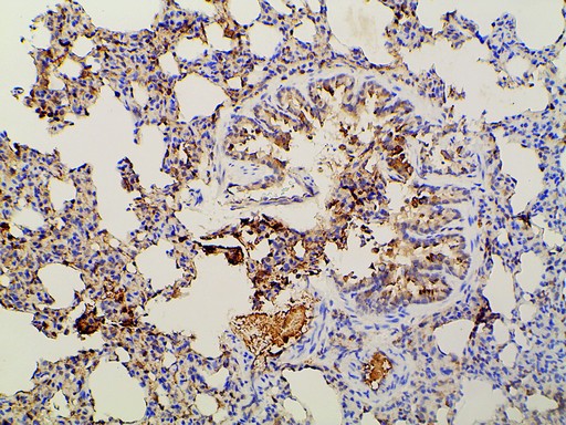 PIK3R1 / p85 Alpha Antibody - 1:100 staining rat lung tissue by IHC-P. The tissue was formaldehyde fixed and a heat mediated antigen retrieval step in citrate buffer was performed. The tissue was then blocked and incubated with the antibody for 1.5 hours at 22°C. An HRP conjugated goat anti-rabbit antibody was used as the secondary.