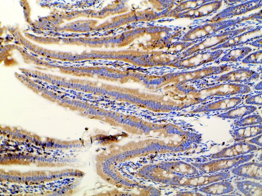 PIK3R1 / p85 Alpha Antibody - 1:100 staining rat Intestinal tissue by IHC-P. The tissue was formaldehyde fixed and a heat mediated antigen retrieval step in citrate buffer was performed. The tissue was then blocked and incubated with the antibody for 1.5 hours at 22°C. An HRP conjugated goat anti-rabbit antibody was used as the secondary.