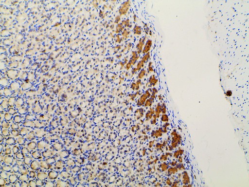 PIK3R1 / p85 Alpha Antibody - 1:100 staining rat gastric tissue by IHC-P. The tissue was formaldehyde fixed and a heat mediated antigen retrieval step in citrate buffer was performed. The tissue was then blocked and incubated with the antibody for 1.5 hours at 22°C. An HRP conjugated goat anti-rabbit antibody was used as the secondary.