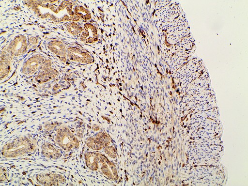 PIK3R1 / p85 Alpha Antibody - 1:100 staining rat uterine tissue by IHC-P. The tissue was formaldehyde fixed and a heat mediated antigen retrieval step in citrate buffer was performed. The tissue was then blocked and incubated with the antibody for 1.5 hours at 22°C. An HRP conjugated goat anti-rabbit antibody was used as the secondary.