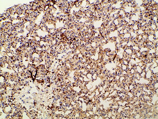 PIK3R1 / p85 Alpha Antibody - 1:100 staining mouse lung tissue by IHC-P. The tissue was formaldehyde fixed and a heat mediated antigen retrieval step in citrate buffer was performed. The tissue was then blocked and incubated with the antibody for 1.5 hours at 22°C. An HRP conjugated goat anti-rabbit antibody was used as the secondary.