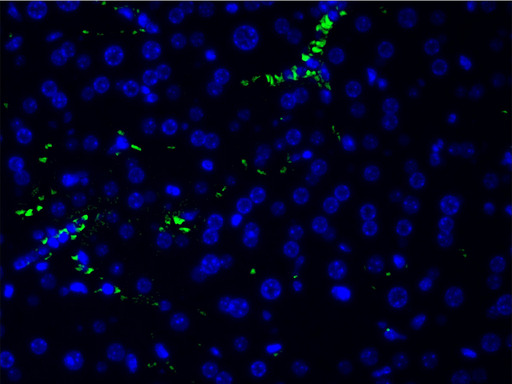 PIK3R1 / p85 Alpha Antibody - 1:200 staining human frozen liver tissue section by IHC-Fr. The sample was incubated with the primary antibody (1:200 in BSA) for 1 hour. An Alexa Fluor 488®-conjugated Goat anti-rabbit antibody was used as the secondary.