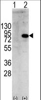 PIK3R1 / p85 Alpha Antibody - Western blot of PIK3R1 (arrow) using rabbit polyclonal PIK3R1 Antibody (Y580). 293 cell lysates (2 ug/lane) either nontransfected (Lane 1) or transiently transfected with the PIK3R1 gene (Lane 2) (Origene Technologies).