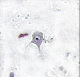 PIK3R2 / p85 Beta Antibody - Formalin-fixed and paraffin-embedded human brain tissue reacted with PIK3R2 Antibody , which was peroxidase-conjugated to the secondary antibody, followed by DAB staining. This data demonstrates the use of this antibody for immunohistochemistry; clinical relevance has not been evaluated.