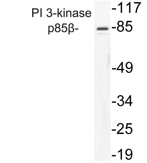 PIK3R2 / p85 Beta Antibody - Western blot analysis of lysate from Jurkat cells, using PI 3-kinase p85Î² antibody.