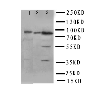PIK3R2 / p85 Beta Antibody - WB of PIK3R2 / p85 Beta antibody. Lane 1: Rat Testis Tissue Lysate. Lane 2: 293T Cell Lysate. Lane 3: HELA Cell Lysate.
