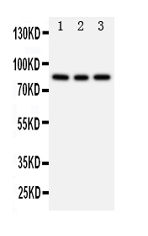 PIK3R2 / p85 Beta Antibody - Western blot analysis of PIK3R2 using anti-PIK3R2 antibody. Electrophoresis was performed on a 5-20% SDS-PAGE gel at 70V (Stacking gel) / 90V (Resolving gel) for 2-3 hours. The sample well of each lane was loaded with 50ug of sample under reducing conditions. Lane 1: Rat Testis tissue lysates, Lane 2: 293T whole cell lysates, Lane 3: HELA whole cell lysates. After Electrophoresis, proteins were transferred to a Nitrocellulose membrane at 150mA for 50-90 minutes. Blocked the membrane with 5% Non-fat Milk/ TBS for 1.5 hour at RT. The membrane was incubated with rabbit anti-PIK3R2 antigen affinity purified polyclonal antibody at 0.5 µg/mL overnight at 4°C, then washed with TBS-0.1% Tween 3 times with 5 minutes each and probed with a goat anti-rabbit IgG-HRP secondary antibody at a dilution of 1:10000 for 1.5 hour at RT. The signal is developed using an Enhanced Chemiluminescent detection (ECL) kit with Tanon 5200 system. A specific band was detected for PIK3R2 at approximately 85KD. The expected band size for PIK3R2 is at 85KD.