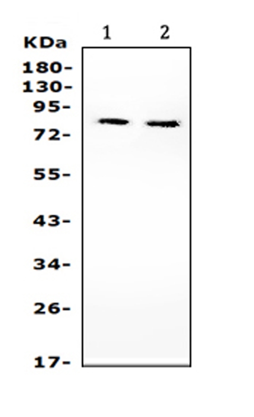 PIK3R2 / p85 Beta Antibody - Western blot analysis of PIK3R2 using anti-PIK3R2 antibody. Electrophoresis was performed on a 5-20% SDS-PAGE gel at 70V (Stacking gel) / 90V (Resolving gel) for 2-3 hours. The sample well of each lane was loaded with 50ug of sample under reducing conditions. Lane 1: mouse liver tissue lysates, Lane 2: mouse brain tissue lysates. After Electrophoresis, proteins were transferred to a Nitrocellulose membrane at 150mA for 50-90 minutes. Blocked the membrane with 5% Non-fat Milk/ TBS for 1.5 hour at RT. The membrane was incubated with rabbit anti-PIK3R2 antigen affinity purified polyclonal antibody at 0.5 µg/mL overnight at 4°C, then washed with TBS-0.1% Tween 3 times with 5 minutes each and probed with a goat anti-rabbit IgG-HRP secondary antibody at a dilution of 1:10000 for 1.5 hour at RT. The signal is developed using an Enhanced Chemiluminescent detection (ECL) kit with Tanon 5200 system. A specific band was detected for PIK3R2 at approximately 85KD. The expected band size for PIK3R2 is at 85KD.