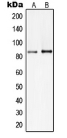PIK3R2 / p85 Beta Antibody - Western blot analysis of PI3K p85 beta expression in HepG2 (A); Raji (B) whole cell lysates.
