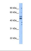 PIK3R3 / p85 Gamma Antibody - Transfected 293T cell lysate. Antibody concentration: 5.0 ug/ml. Gel concentration: 12%.  This image was taken for the unconjugated form of this product. Other forms have not been tested.