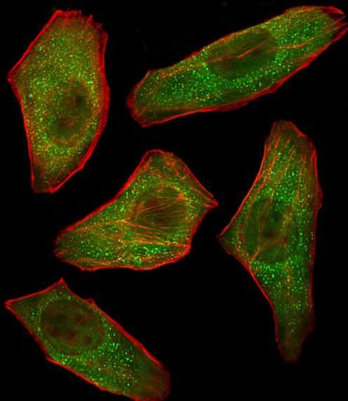 PIK3R3 / p85 Gamma Antibody - Fluorescent image of U251 cells stained with PIK3R3 Antibody. Antibody was diluted at 1:100 dilution. An Alexa Fluor 488-conjugated goat anti-rabbit lgG at 1:400 dilution was used as the secondary antibody (green). Cytoplasmic actin was counterstained with Alexa Fluor 555 conjugated with Phalloidin (red).