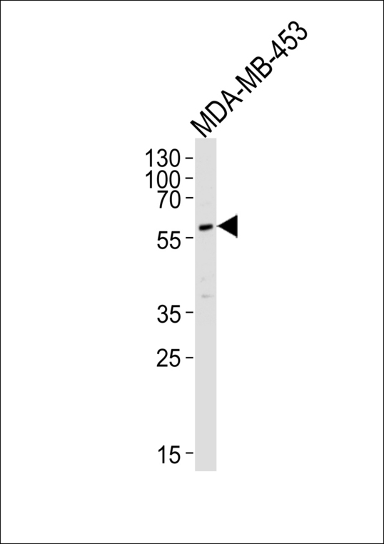 PIK3R3 / p85 Gamma Antibody - Western blot of lysate from MDA-MB-453 cell line, using PI3KR3 Antibody (G331). RB1719 was diluted at 1:1000 at each lane. A goat anti-rabbit IgG H&L (HRP) at 1:5000 dilution was used as the secondary antibody. Lysate at 35ug per lane.