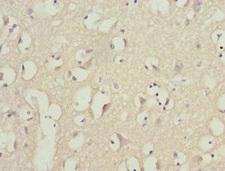 PIK3R3 / p85 Gamma Antibody - Immunohistochemistry of paraffin-embedded human brain tissue at dilution 1:100