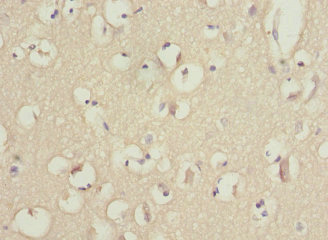 PIK3R3 / p85 Gamma Antibody - Immunohistochemistry of paraffin-embedded human brain tissue at dilution 1:100