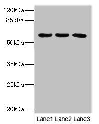 PIK3R3 / p85 Gamma Antibody - Western blot All Lanes: PIK3R3 antibody at 3.5ug/ml Lane 1: MCF7 whole cell lysate Lane 2: Jurkat whole cell lysate Lane 3: Mouse gonadal tissue Secondary Goat polyclonal to Rabbit IgG at 1/10000 dilution Predicted band size: 55,48,44 kDa Observed band size: 54 kDa