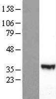PIK3R3 / p85 Gamma Protein - Western validation with an anti-DDK antibody * L: Control HEK293 lysate R: Over-expression lysate