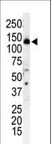 PIK3R4 Antibody - Western blot of anti-PI3KR4 antibody in T-47D cell lysate. PI3KR4 (arrow) was detected using purified antibody. Secondary HRP-anti-rabbit was used for signal visualization with chemiluminescence.