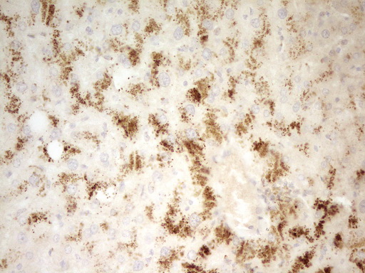 PIK3R4 Antibody - IHC of paraffin-embedded Human liver tissue using anti-PIK3R4 mouse monoclonal antibody. (Heat-induced epitope retrieval by 1 mM EDTA in 10mM Tris, pH8.5, 120°C for 3min).