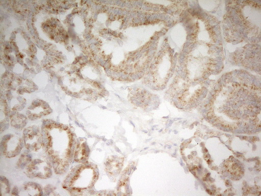 PIK3R4 Antibody - IHC of paraffin-embedded Human thyroid tissue using anti-PIK3R4 mouse monoclonal antibody. (Heat-induced epitope retrieval by 1 mM EDTA in 10mM Tris, pH8.5, 120°C for 3min).